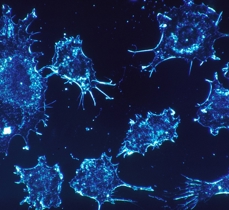 Cancer Cells 541954 960 720 Pixabay 980 X 625