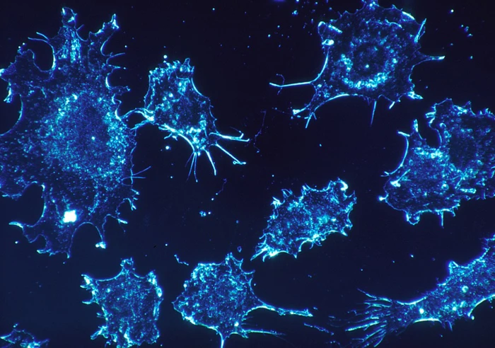 Cancer Cells 541954 960 720 Pixabay 980 X 625
