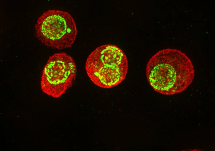 Malaria Virulence, Drug Discovery And Resistance