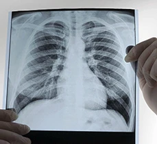 Dreamstime Xxl 209238243 510X288