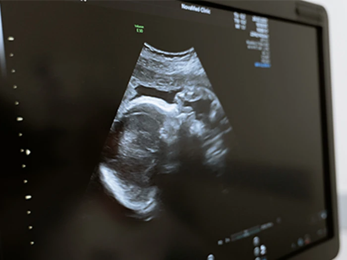 Accelerating Innovation For Mothers AIM 2.0