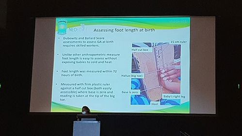 One of the symposium presentations was about a homemade device to measure the length of a newborn baby’s foot as a proxy for low birth weight. Credit: Stefanie Vaccher