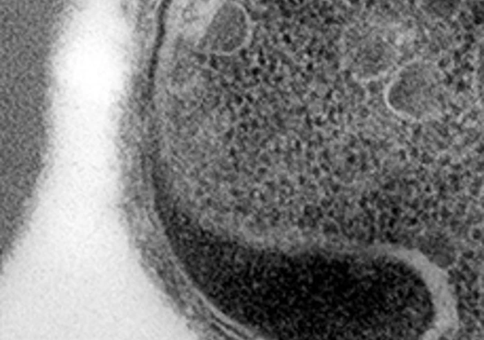 Electron Microscopy Image Of Merozoite Attached To Red Blood Cell Before It Starts Invasion Process 510X288