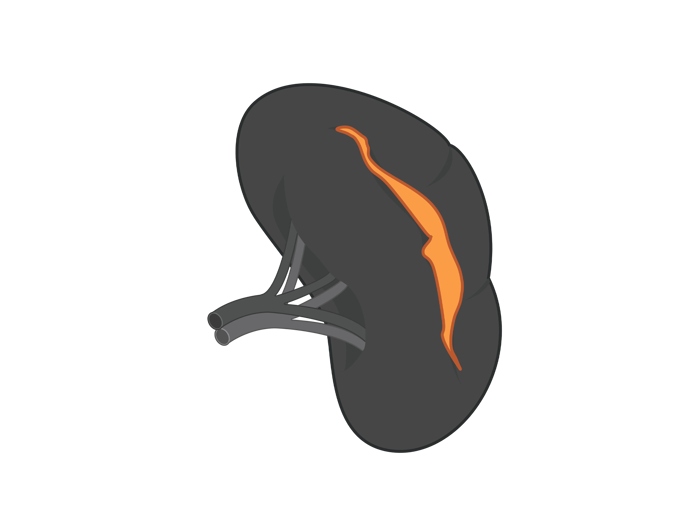 Spleen illustration.