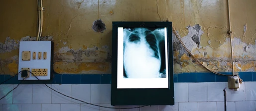 Tackling TB and HIV Together in Papua New Guinea