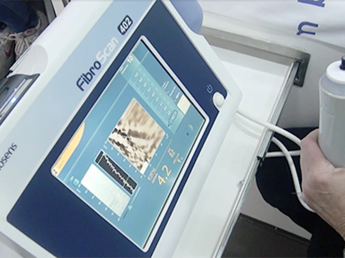 Fibroscan 510X288