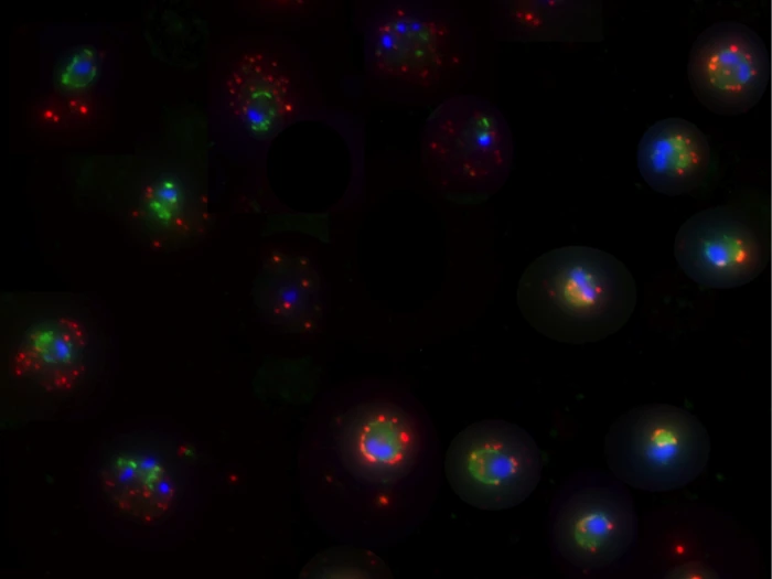 Project Image Option 1 Vaccines Against Malaria Caused By Plasmodium Falciparum And P.Vivix