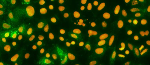 COVID-19 antigens for PoC test development