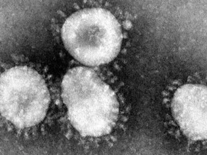 Coronaviruses 004 Lores