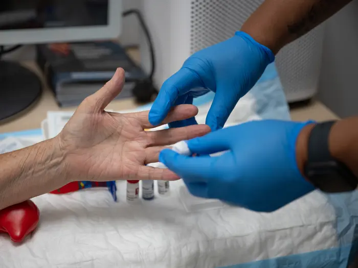 A nurse collects a finger prick test sample.