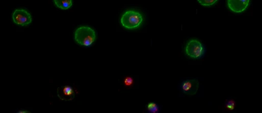 Discovering novel antimalarials to block parasite virulence