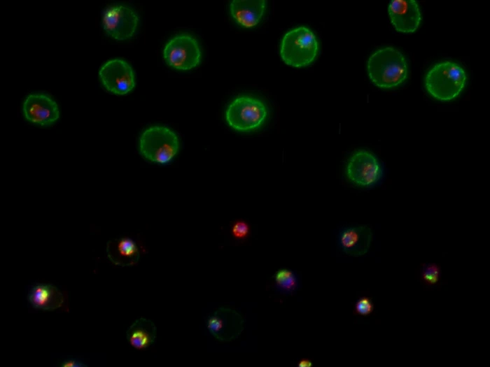 Image Developing New Antimalarial Drugs That Block Protein Trafficking (1)