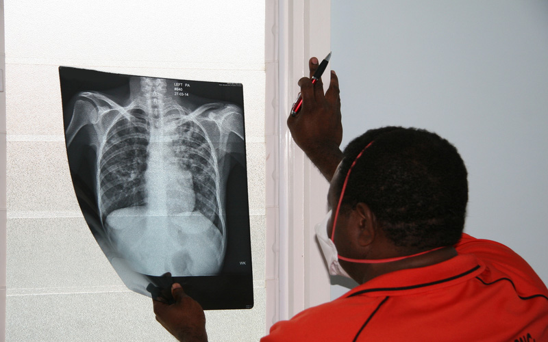 Man looking at a chest x-ray against a window light.